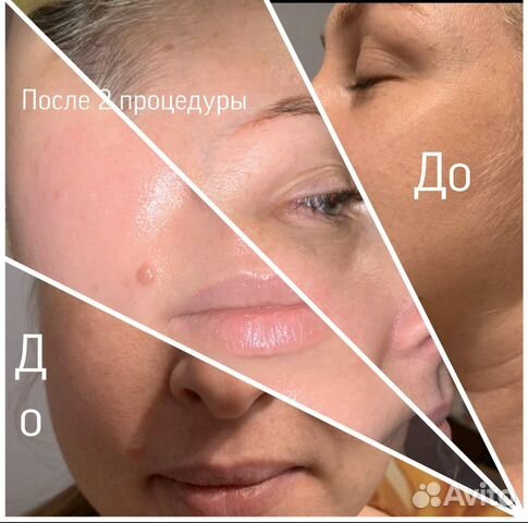 Массаж. Скульптурный массаж лица. Все виды массажа