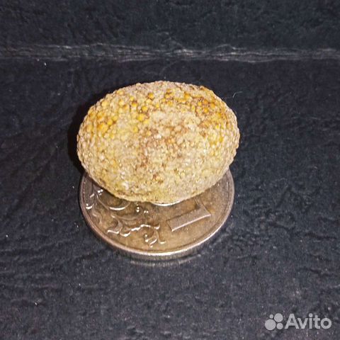 Камень желчного пузыря