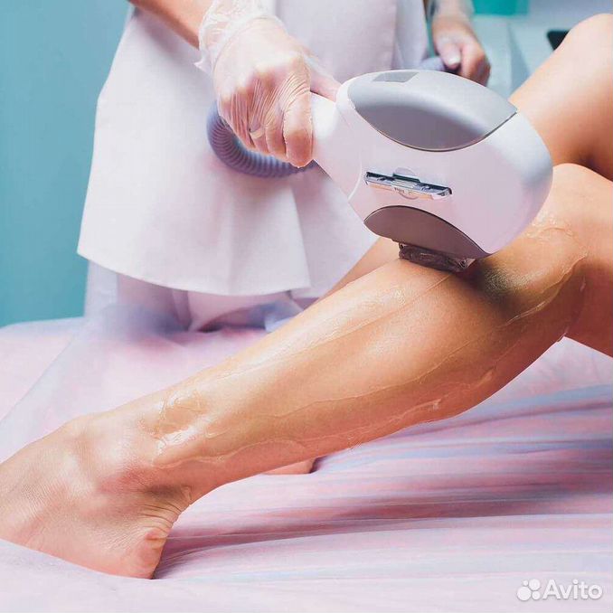 Фотоэпиляция элос. Лазерная эпиляция. Лазерная эпиляция голени. Лазерная эпиляция авито. Фотоэпиляция ног.